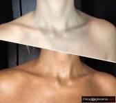 OPALANIE NATRYSKOWE (SPRAY TAN) w Bartlett