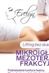 Zapraszam na microneedling - mezoterapia mikroigłowa!