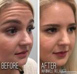 Laser L’amour Spa w South Barrington