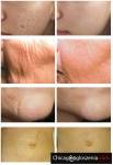 Gosia Beauty Horizon